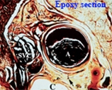 PlastMat Epoxy Resin System